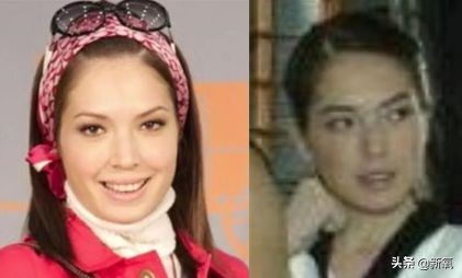 盘点整容后不敢认的女星颜值巅峰,知名女网红被扒整容