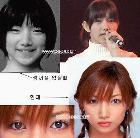 日本整容的鬼斧神工，来见识一下各位日星是整容了还是“长开”了