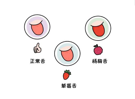 如何通过舌苔判断宝宝健康,中医教你从14种舌头的舌象看健康
