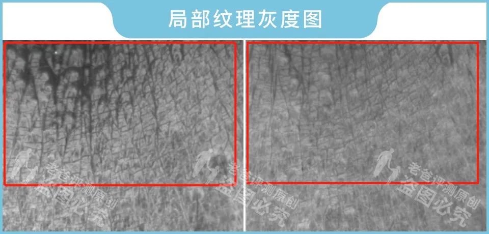 眼霜对黑眼圈有用吗,眼霜去细纹黑眼圈真实有效