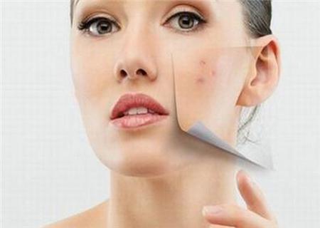 脸上起小痘痘怎么办医美,医美脸上长痘坑坑洼洼的怎么修复