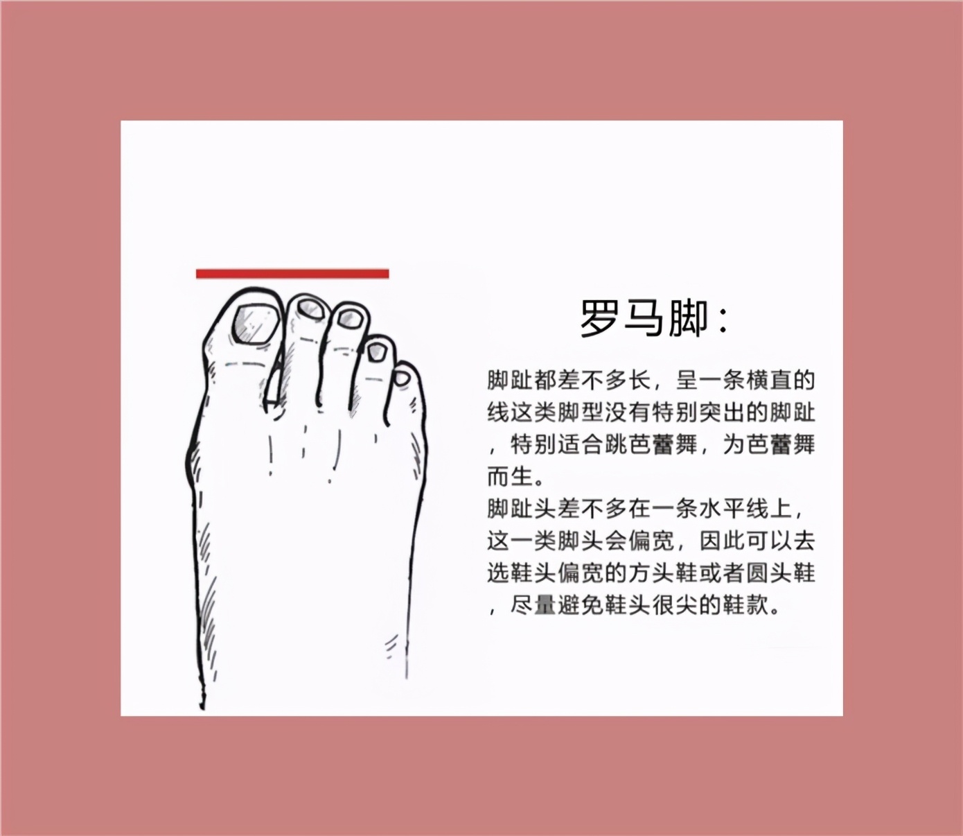 不同脚型适合的鞋子,鞋子不一定要贵只要合脚就行