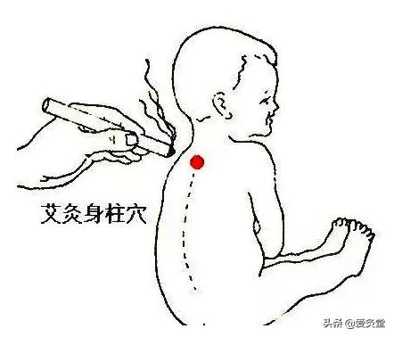 夏天艾灸和冬天艾灸,又到了艾灸的季节