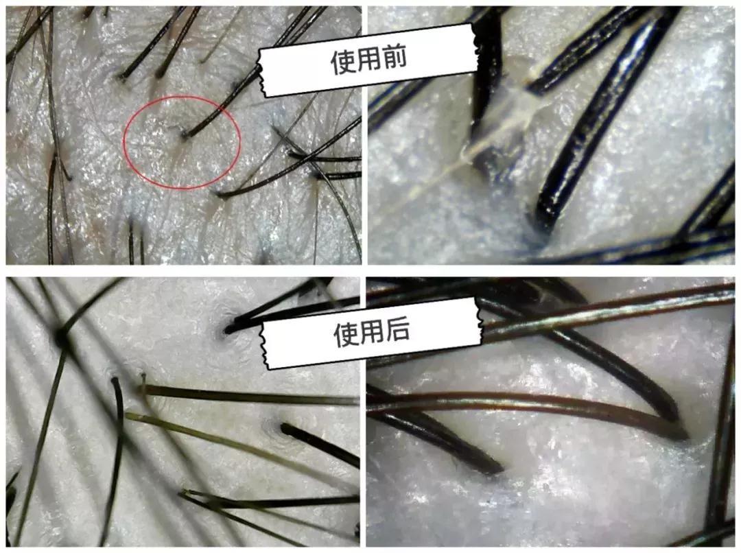 比较好用的德国防脱发,德国十大最好用的护肤品