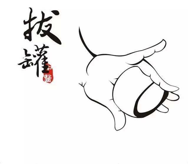 拔罐的好处那么多还要注意哪些