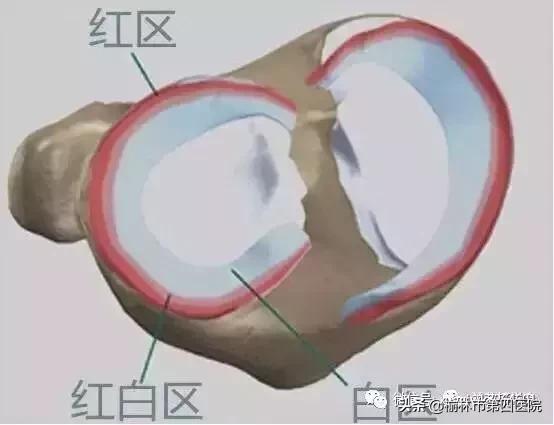 内侧半月板后角损伤怎么治疗,prp治疗半月板损伤有用吗