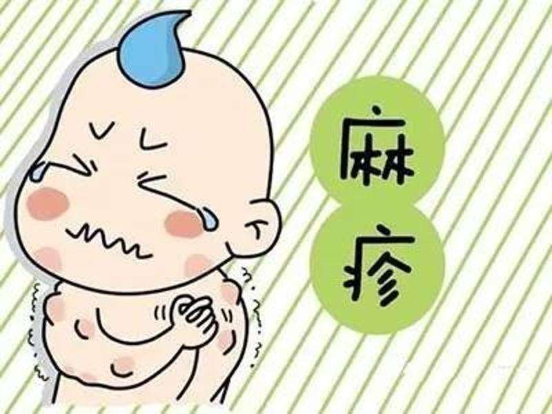 荨麻疹是由麻疹病毒引起的吗,麻疹是伤寒吗