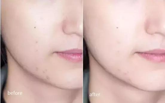 美丽新肌面膜,最全医美护肤面膜