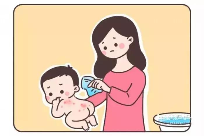 宝宝容易长痱子用什么爽身粉,宝宝长痱子怎么用炉甘石洗剂