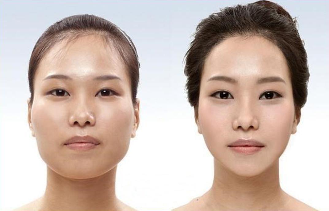 整容最成功的美人,整容最成功的13个人