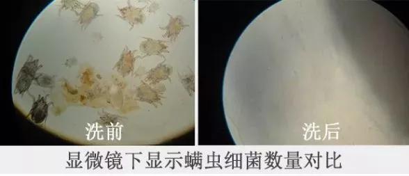专治螨虫的洗面奶,螨虫专用洁面乳