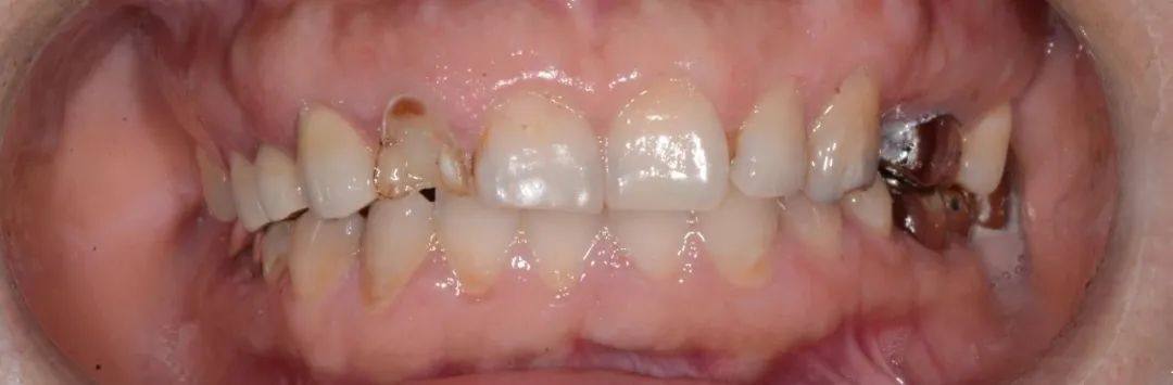 美白牙膏去牙黄真实有效测评,美白牙膏真实测评护牙效果