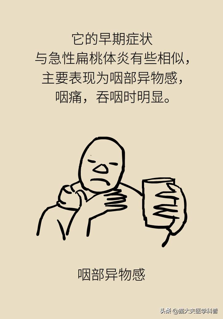 扁桃体肿大一侧和两侧区别,单侧扁桃体肿大患癌的几率是多少