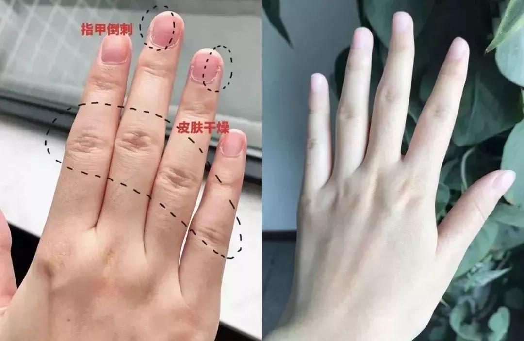 祛除角质细纹的护手霜,干裂护手霜秋冬季