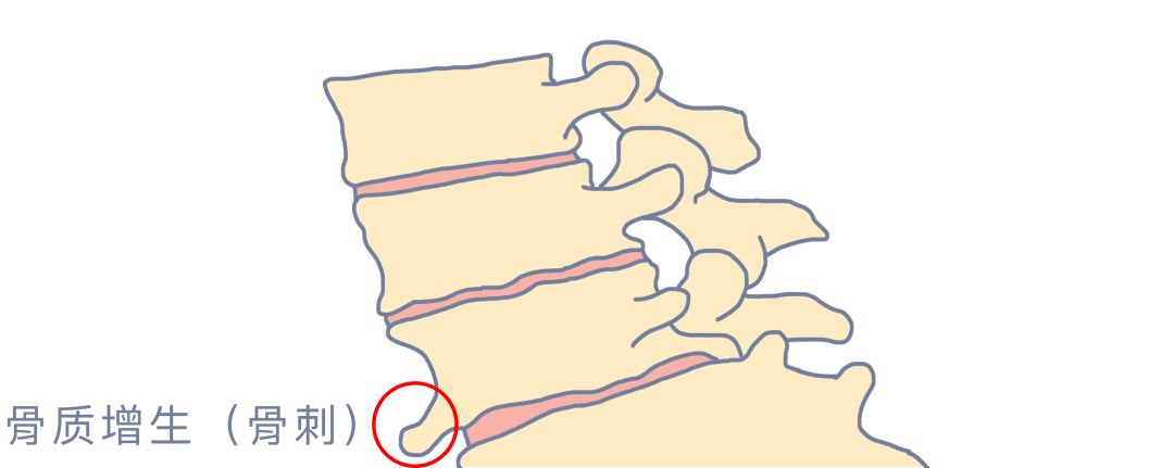 体检时发现结节增生囊肿怎么回事,查出息肉结节怎么办