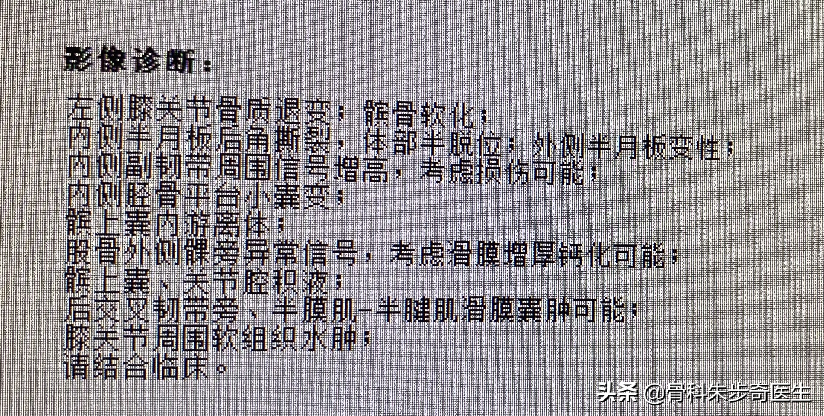 膝关节有骨刺应该怎么治,早期膝关节有骨刺怎么能治愈