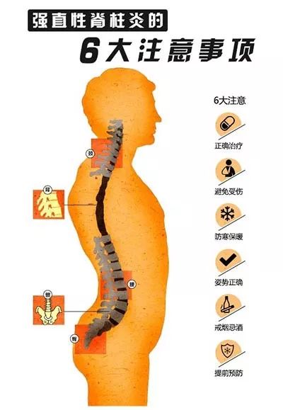 腰背、关节疼痛，先到风湿免疫科就诊，排除强直性脊柱炎
