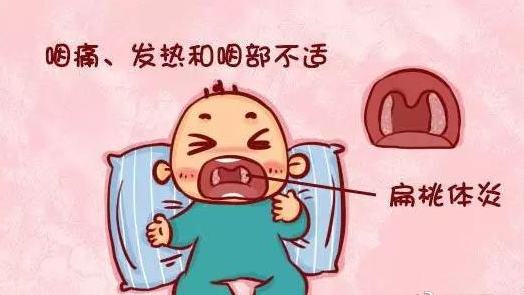 宝宝扁桃体炎一般什么原因引起,宝宝扁桃体发炎怎么引起的