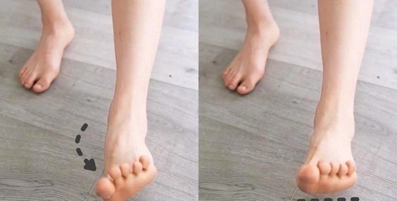 o型腿按摩教学视频,按摩改善小腿肌