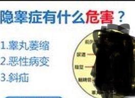 男宝宝的蛋蛋怎么不见了