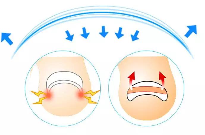 甲沟嵌甲从根部戳到肉里面怎么办,脚趾甲侧面嵌甲自己怎么处理