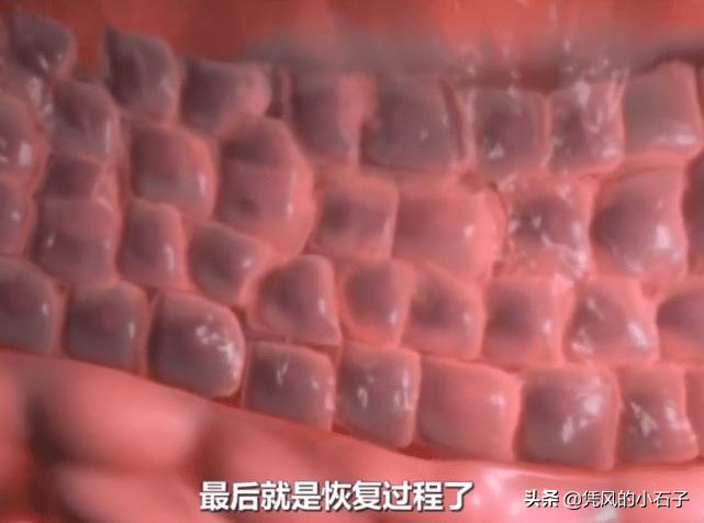人受伤后伤口怎么愈合?显微镜放大100倍,看完长见识了