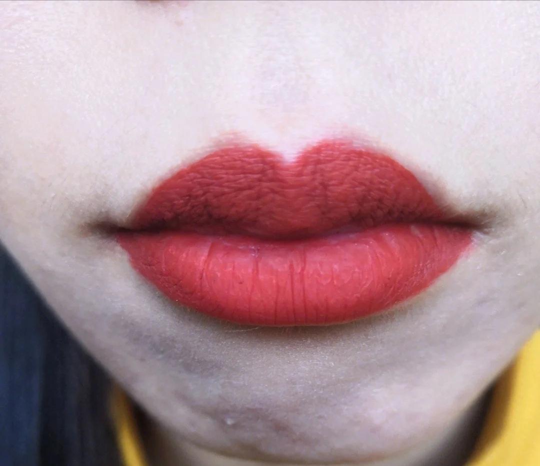 嘴唇好丑怎么变好看,嘴唇为何会越变越难看