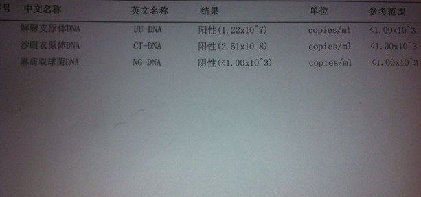 衣原体感染是炎症吗,衣原体感染白细胞和脓尿一样吗