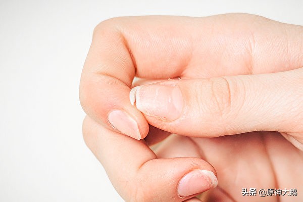 指甲易脆裂缺哪个维生素,指甲变脆容易折断缺什么维生素