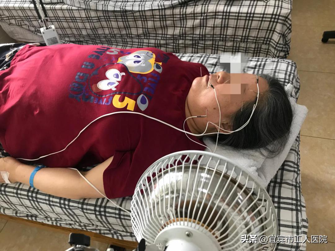 宜宾中医院治疗面瘫,宜宾哪家医院治疗面瘫最好