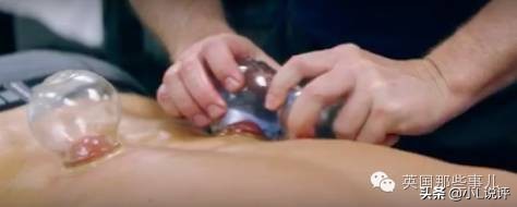 来自东方的神秘力量，让老外痴迷的拔火罐和蚊帐