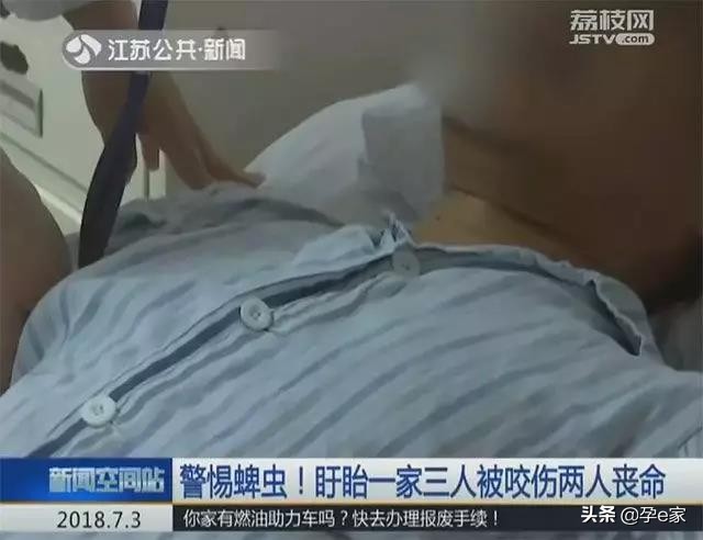 身上出现许多小黑痣,身上出现凸起黑痣一定要重视