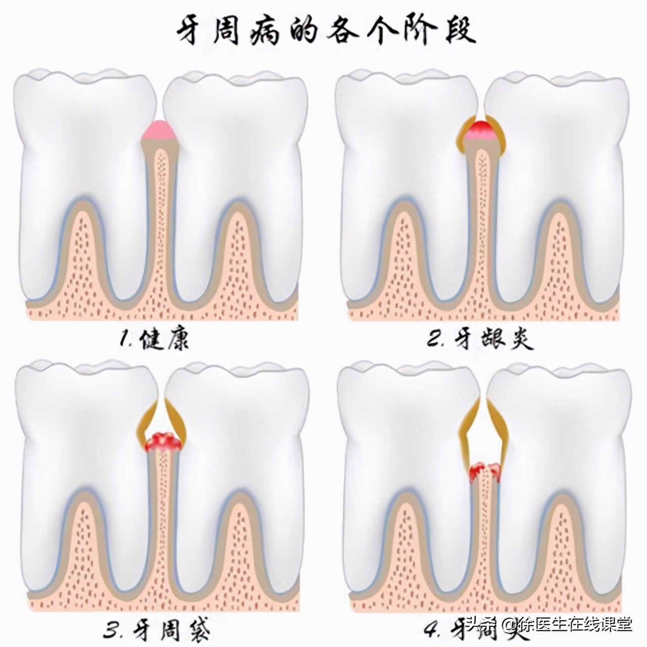 甲硝唑便宜又实用都能搞定哪些病,甲硝唑哪一种见效快图片