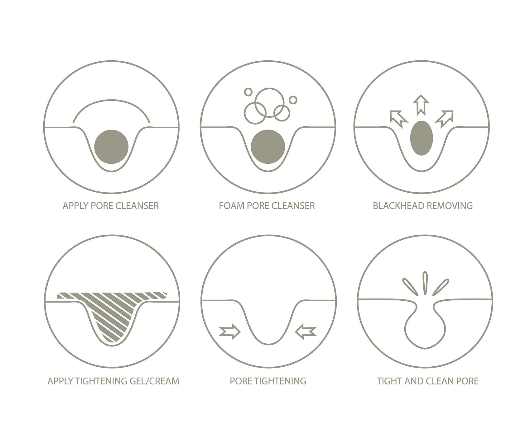 教你快速消灭脸上闭口型痘痘,皮肤科医生教你3步消灭闭口粉刺