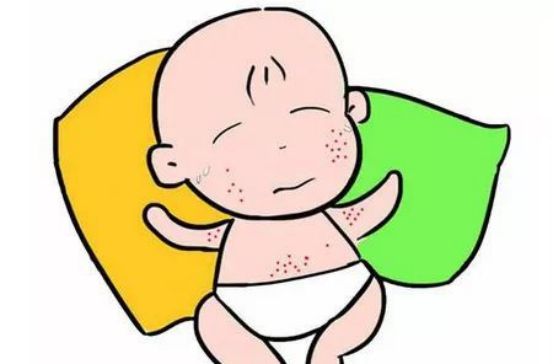 为什么春季泛发性湿疹高发期,季节交替是湿疹高发期宝宝篇