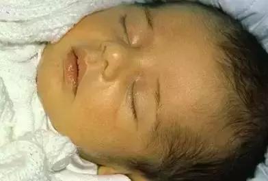 刚出生的宝宝特殊现象,刚出生宝宝吓住了怎么办