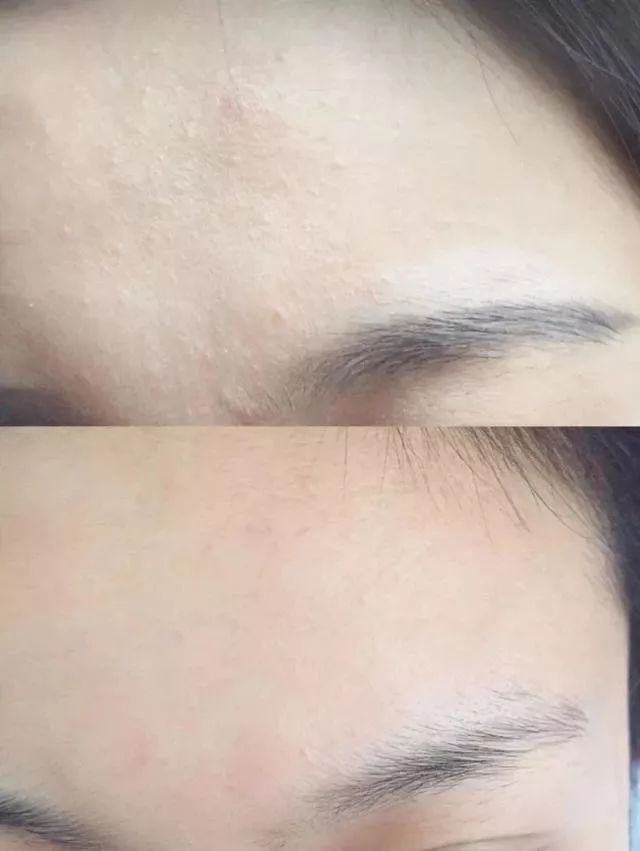 日本takami美容液,takami角质美容液测评