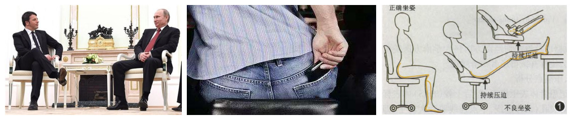 屁股骨头疼连带腿麻,屁股肌肉痛腿也肌肉疼是怎么回事