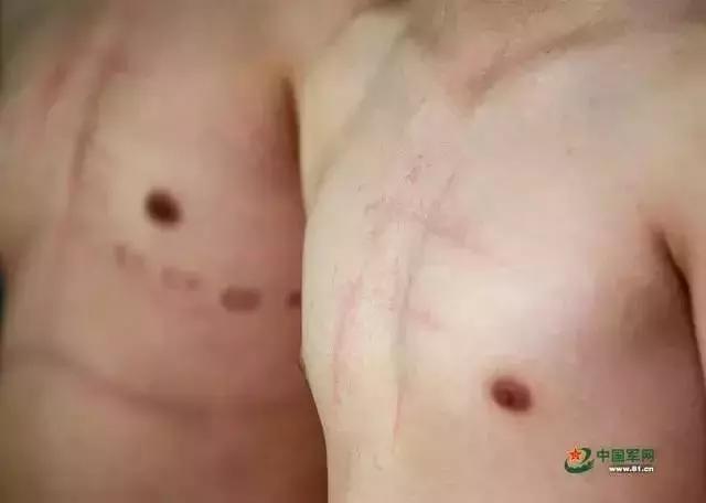 征兵体检前一天注意事项,征兵体检时有什么要注意的事项