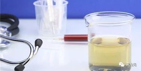 尿量减少还可以恢复吗,肾病综合征尿少浮肿是肾衰竭吗