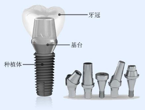 大连齿医生口腔医院地址,大连齿医生口腔科普