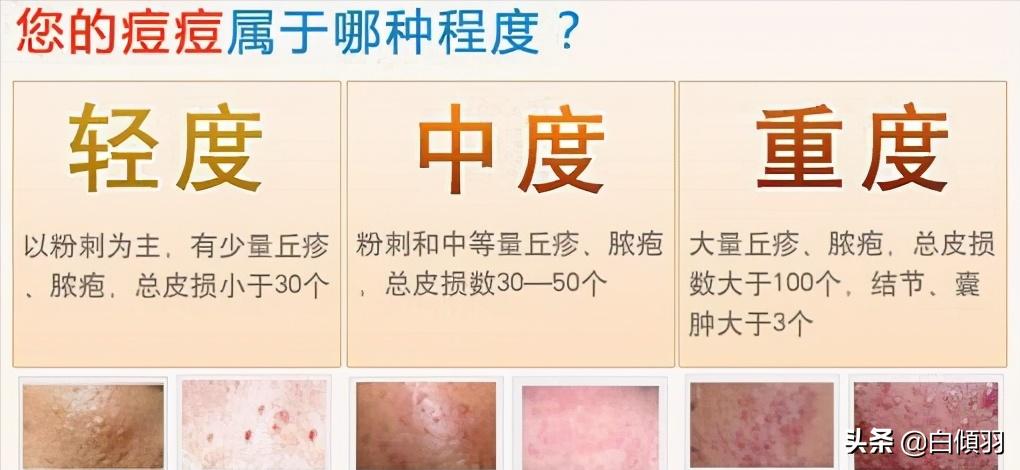 红肿硬块痘痘没有脓怎么快速消退,红肿痘痘不疼了但是还是有包