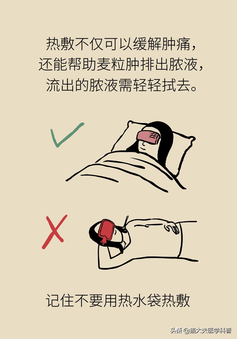 爱长针眼怎么回事,爱长针眼咋整