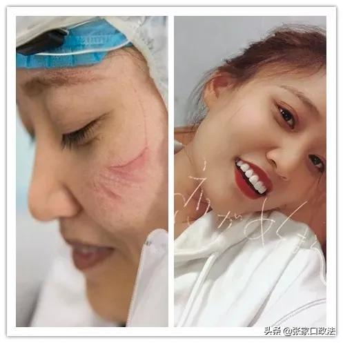 阳原人，我终于看清你了