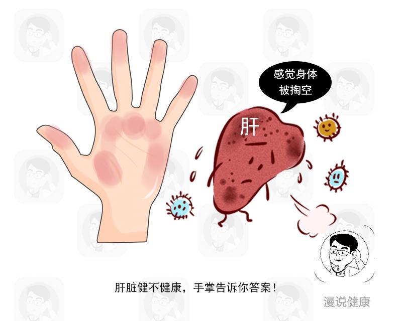 肝病患者出现的问题,肝病皮肤问题表现