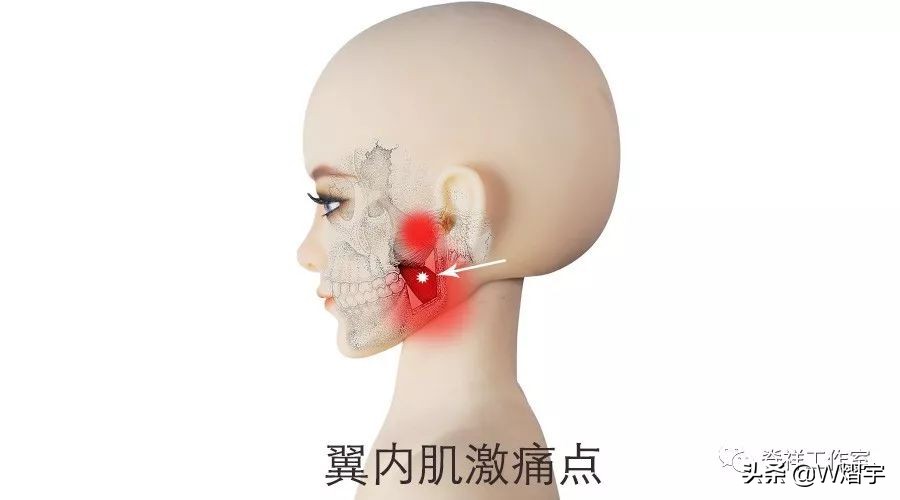 吞咽痛并有痰是什么原因,吞咽时舌下疼怎么办