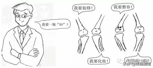 骨性关节炎诊疗指南,骨性关节炎诊疗指南欧美