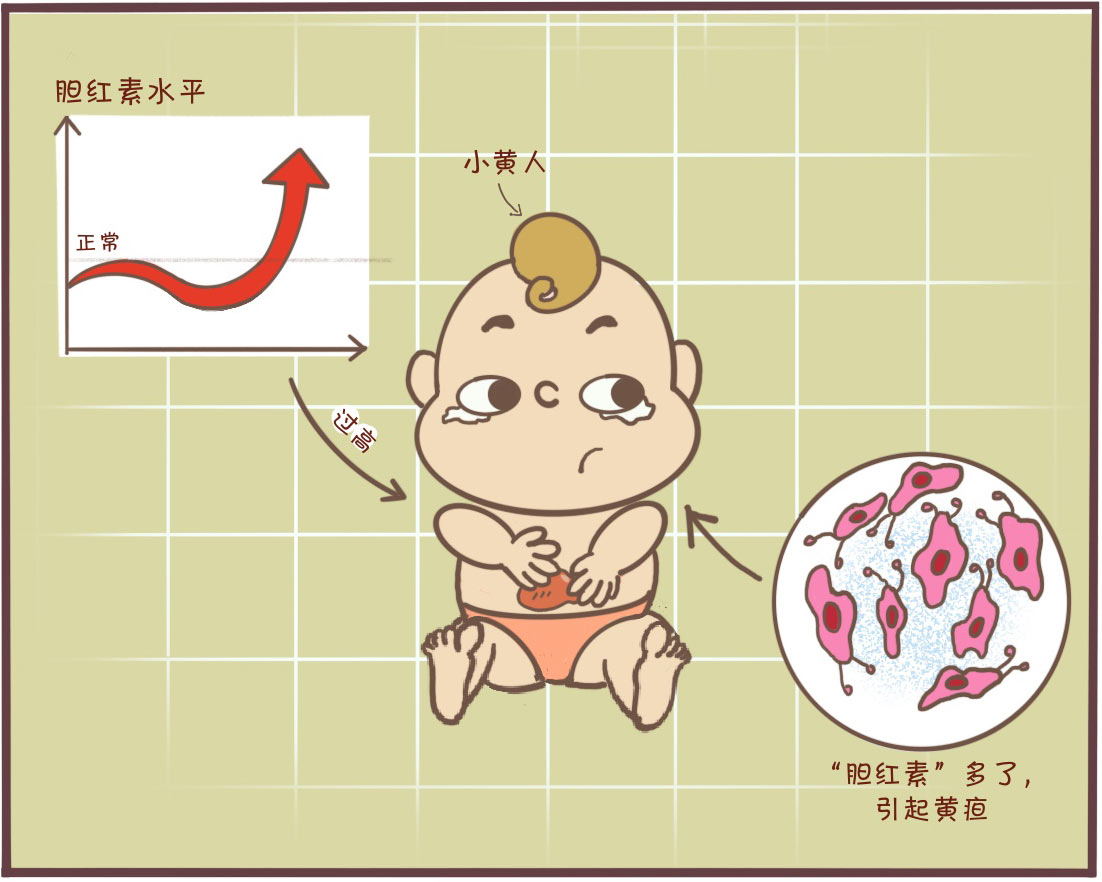 黄疸高晒太阳晒多久可以去除黄疸,生理性黄疸晒太阳黄疸下得快吗