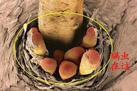 床单不洗螨虫成千上万,床单30天不洗竟螨虫成堆