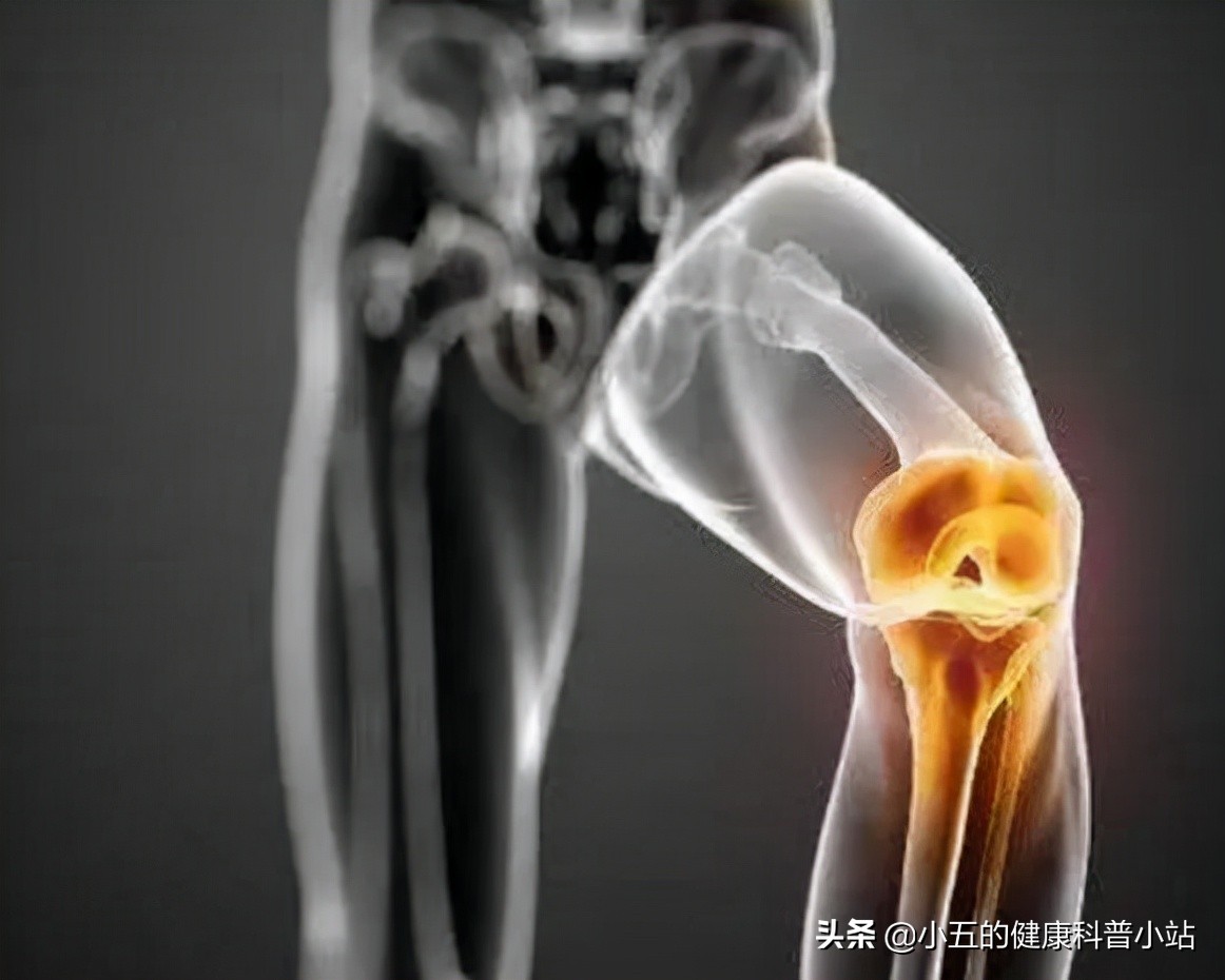 膝关节咔咔响发软是怎么回事,膝关节咔咔响乏力